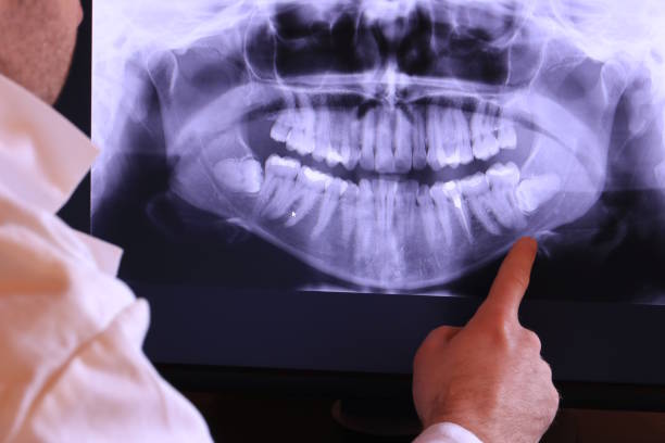 Best After-Hours Emergency Dentist in Port Labelle, FL