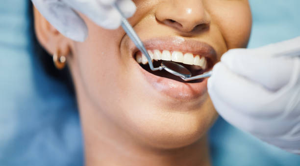 Best Same-Day Emergency Dentist in Port Labelle, FL